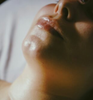 Effektiv rynkebehandling: Laser og injeksjoner