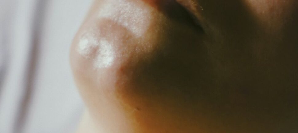 Effektiv rynkebehandling: Laser og injeksjoner